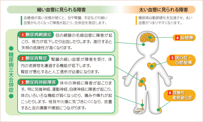 糖尿病センター