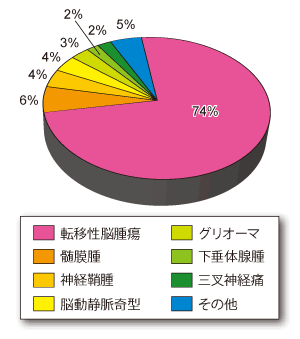 ガンマナイフ