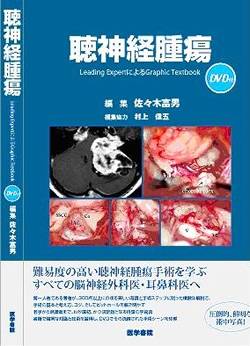 聴神経腫瘍