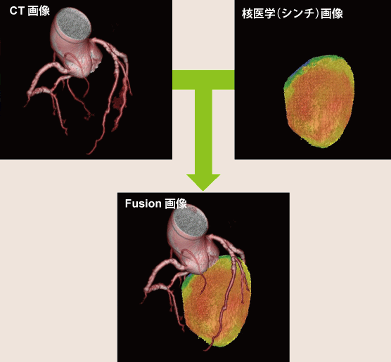 Fusion（融合）画像