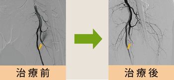 治療症例