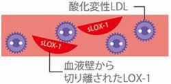 頭部MRI・MRA画像