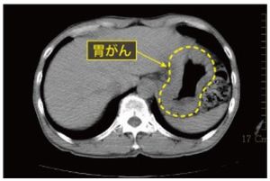 頭部MRI・MRA画像