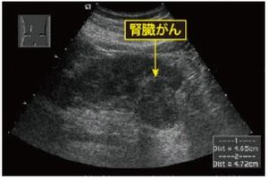 頭部MRI・MRA画像