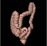 大腸3次元画像