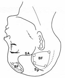 Fig.1