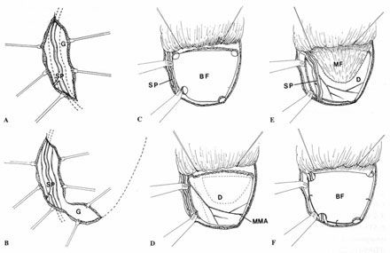 Fig.2