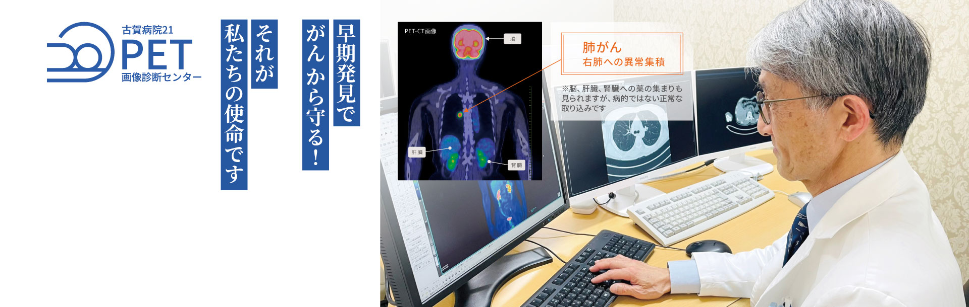 PET画像診断センター